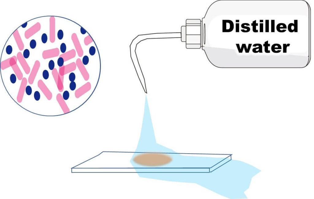 Final step in Gram staining: Using distilled water to rinse the slide, showing Gram-positive bacteria in purple and Gram-negative bacteria in pink.
