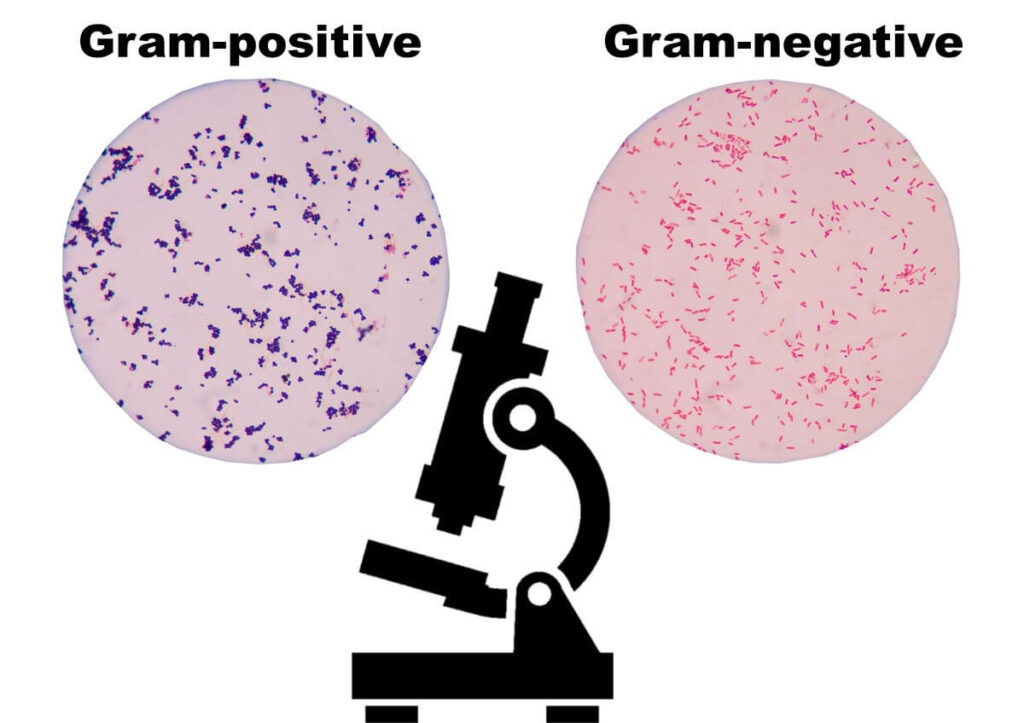 Gram staining step 5.