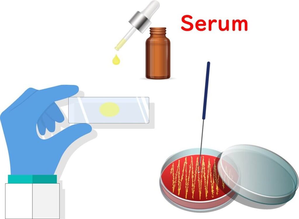 Serotyping methods for E. coli using serum reaction to identify O and H antigens for specific strain detection.　