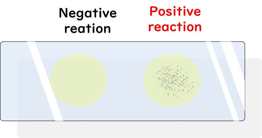 Comparison of positive and negative reactions in serotyping E. coli using serum reaction slides.