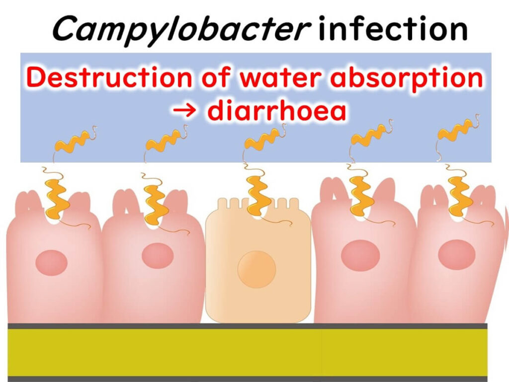 Campylobacter-infection-in-intestinal-epithelial-cells.