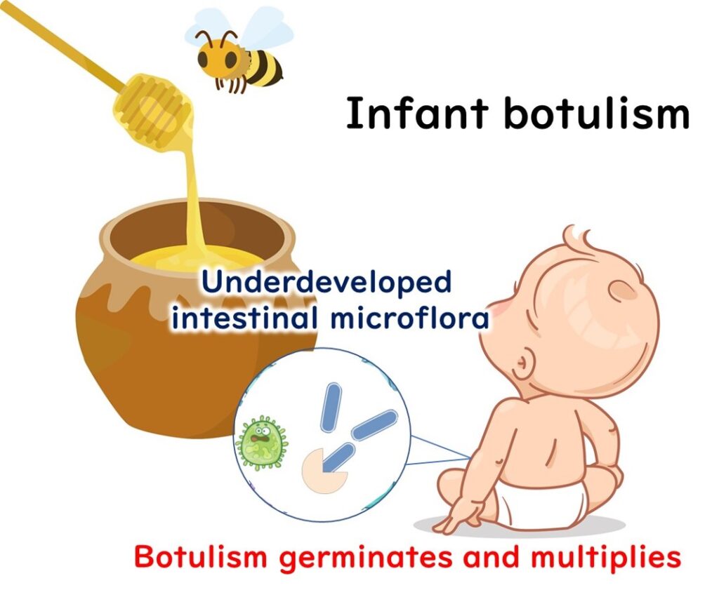 Infants get botulism food poisoning from honey.