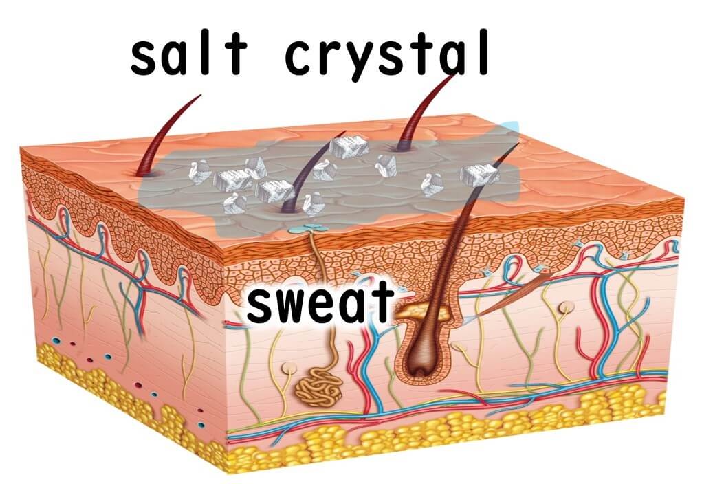 Salt crystals on the surface of the skin