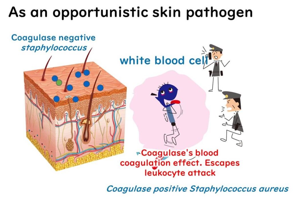 Staphylococcus aureus producing coagulase on the surface of the skin.
