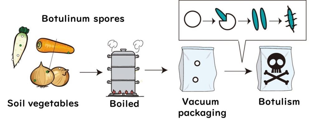 Typical pattern of botulinum food poisoning.