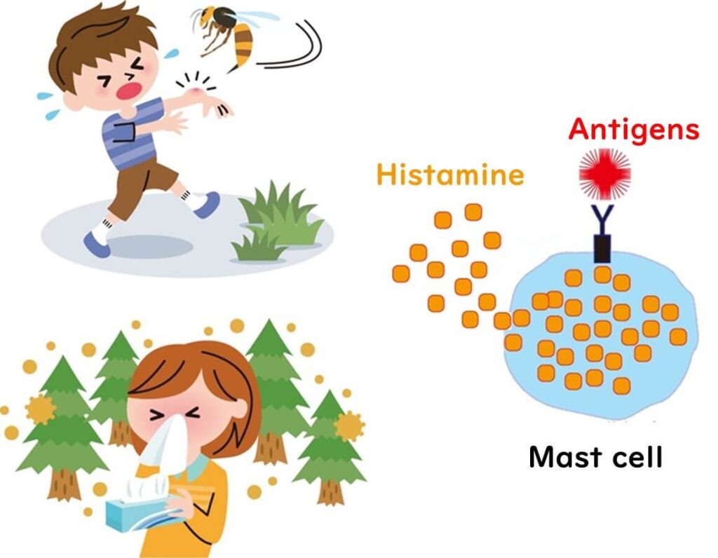 Illustration showing histamine poisoning.