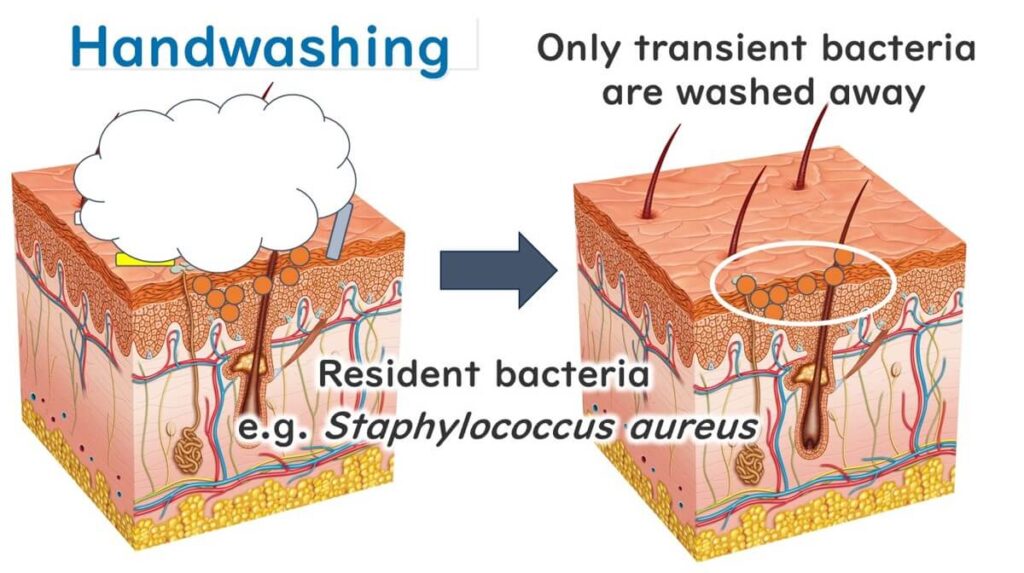 Handwashing Nuances: Efficacy Against Transient Bacteria vs. Resident Flora